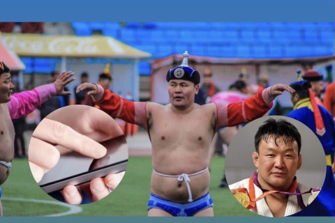 Э.Энхбат начин ухаан орсон ч ярьж, хөдөлж чадахгүй байна