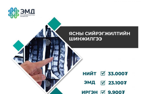 Ясны сийрэгжилтийн шинжилгээний 70 хувийг ЭМД-ын сангаас хөнгөлнө