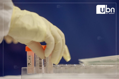 ЭМДЕГ: Шимэгч судлалын шинжилгээг үнэ төлбөргүй өгнө