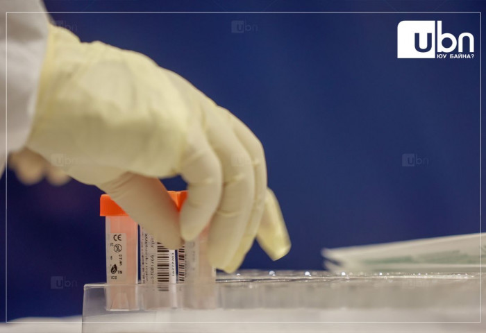 Шимэгч тодорхойлох шинжилгээний төлбөрийг ЭМД-аас 100 хувь хариуцна