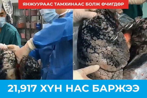 Янжуур тамхинаас болж 21917 хүн нас баржээ