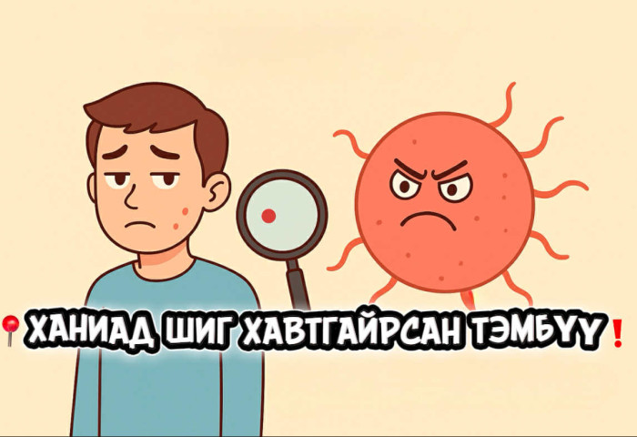 ХАНИАД ШИГ ХАВТГАЙРСАН ТЭМБҮҮ